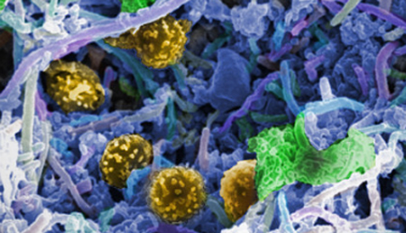 Interacción entre el microbioma y la composición genética personal