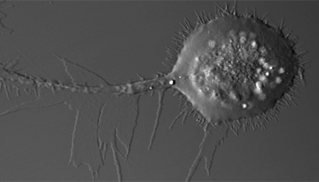 Científicos españoles descubren una nueva vía que podría frenar la metástasis en cáncer de pulmón