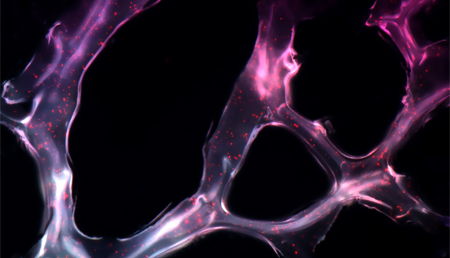 Identificados nuevos genes de predisposición y microRNAs involucrados en el cáncer hereditario