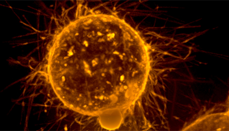 Identificado un nuevo mecanismo de actuación de la proteína LOXL2 en la progresión tumoral