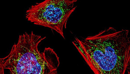 La peroxirredoxina podría remover el peróxido de hidrógeno de las mitocondrias