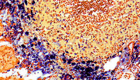 Investigadores diseñan nanorobots de ADN