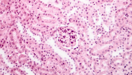 Describen como LAT2/CD98hc y TAT1 podrían tener una implicación en la reabsorción renal