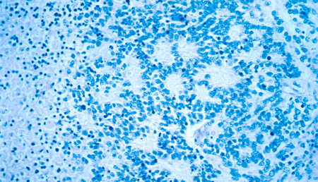 La sobreexpresión de un receptor de estrógenos podría promover su diferenciación en células neuronales