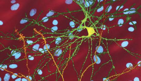 El déficit de Pyk2 modula las alteraciones cognitivas en la enfermedad de Huntington