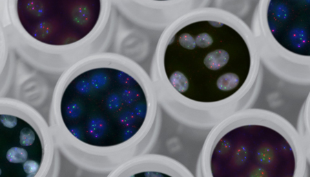 Obtenidos los epigenomas completos de los tumores más frecuentes