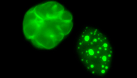 Identifican defectos en el corazón de pacientes con progeria que aumentan el riesgo de arritmias y muerte prematura