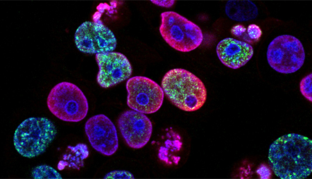 Investigadores españoles descubren que la excesiva replicación del ADN puede ser devastadora para las células