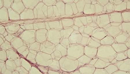 Nueva técnica para medir la actividad del tejido adiposo marrón, un órgano clave en el desarrollo de la obesidad