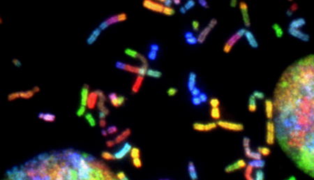 Mutaciones en el gen INPP5K podrían definir un nuevo tipo de distrofia muscular congénita