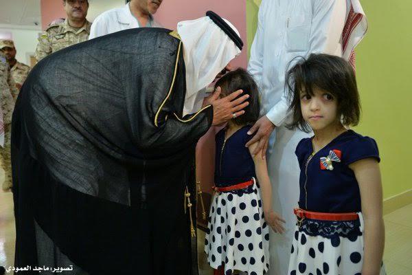 بالصور.. التوأم السيامي السعودي بالصور.. التوأم السيامي السعودي