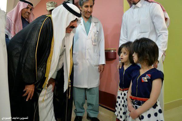 بالصور.. التوأم السيامي السعودي بالصور.. التوأم السيامي السعودي