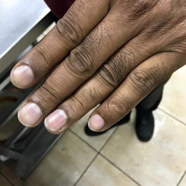 بالصور مخالفات صحية تغلق فرع 