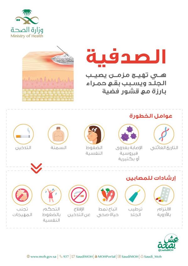 مرض الصدفية مرض الصدفية