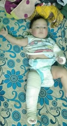 وحشية أب مصري.. عذب رضيعة وكسر أطرافها لرفضه إنجاب الإناث