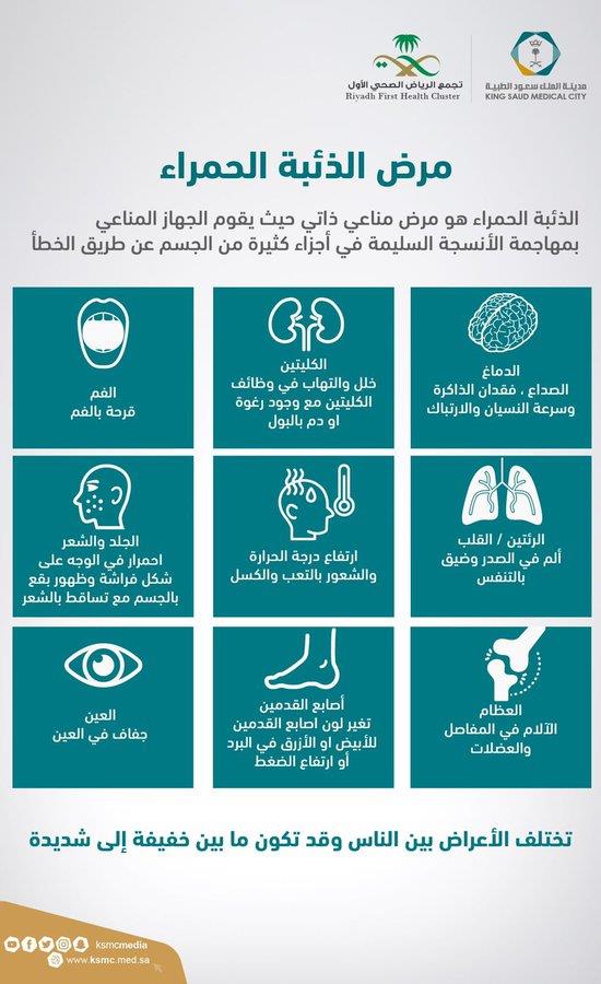 الذئبة الحمراء