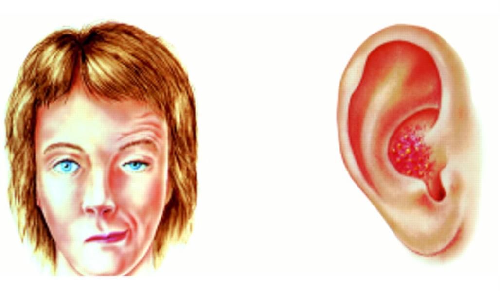 هل تشعر بألم خلف الأذن هل تشعر بألم خلف الأذن