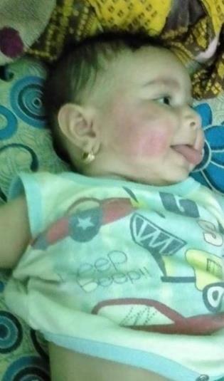 وحشية أب مصري.. عذب رضيعة وكسر أطرافها لرفضه إنجاب الإناث