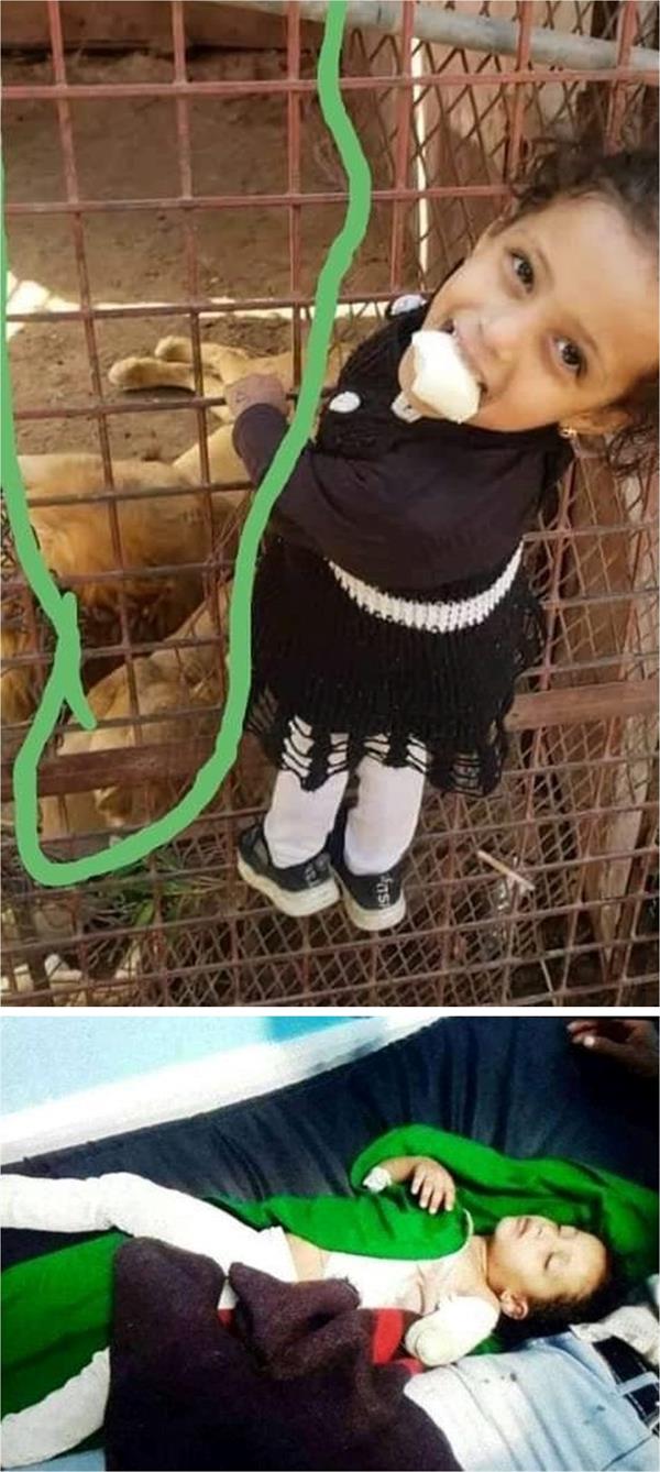 أسد يلتهم يد طفلة يمنية في حديقة الحيوانات
