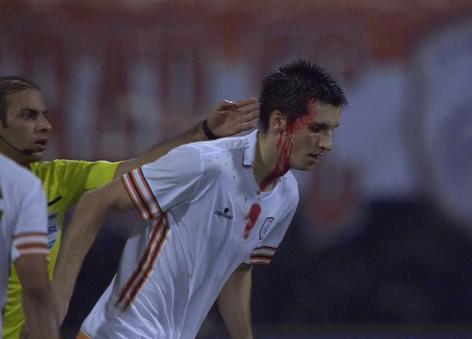 اصابة قوية لماوريسيو افونسو امام نجران ( صورة )