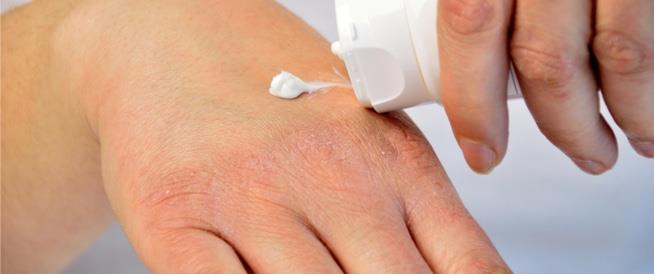 مشاكل الجلد