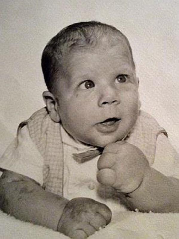 أمريكي يمتلك يدًا ضخمة تشبه يد شخصية باباي الكرتونية- صور