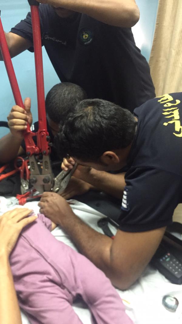 مدني المدينة يستخرج يد طفل محتجزه داخل صافرة قدر الضغط