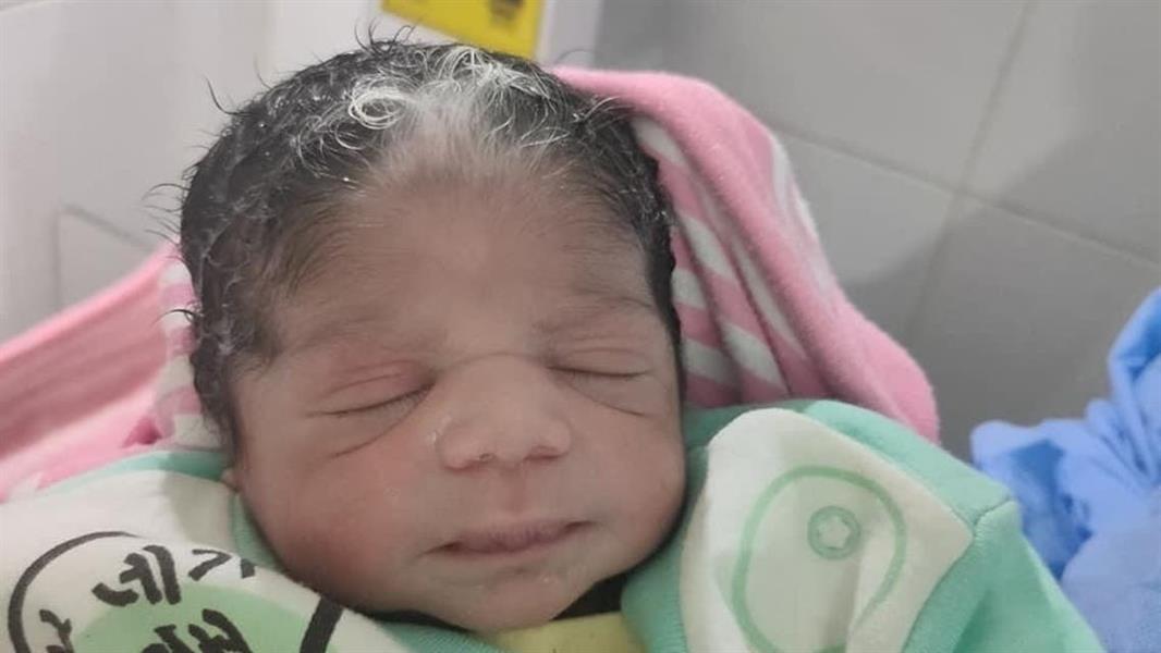 واقعة غريبة بمصر.. ولادة طفلة بشعر أبيض في الأقصر واقعة غريبة بمصر.. ولادة طفلة بشعر أبيض في الأقصر