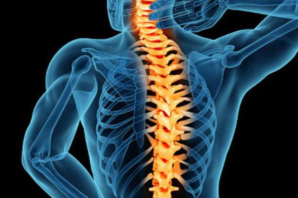 "الصحة" توضح ما هو" الجنف" وطرق علاجه