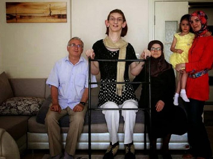 اطول فتاه في العالم