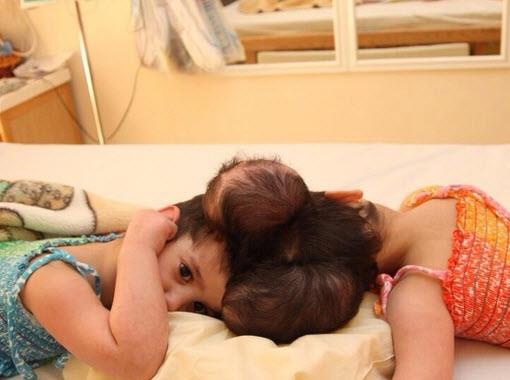 بالصور.. التوأم السيامي السعودي رنا ورنيم في أحضان الأمير متعب بعد سنتين من نجاح فصلهما بالصور.. التوأم السيامي السعودي رنا ورنيم في أحضان الأمير متعب بعد سنتين من نجاح فصلهما