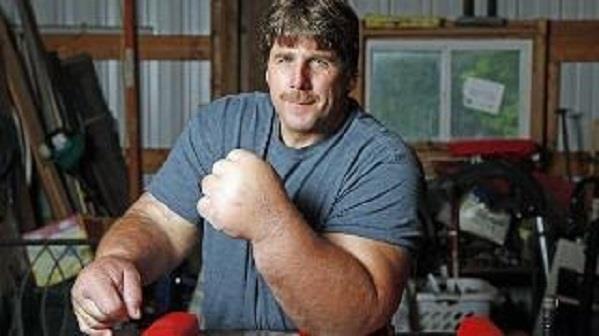 أمريكي يمتلك يدًا ضخمة تشبه يد شخصية باباي الكرتونية- صور