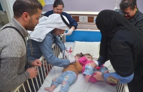 بالصور.. التوأم السيامي المصري تصلان إلى مستشفى الحرس الوطني والربيعة يطمئن عليهما