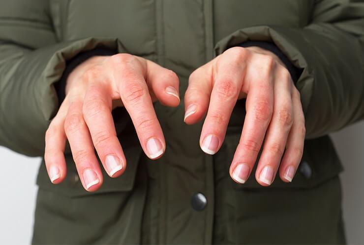 تعرّف على أعراض مرض 