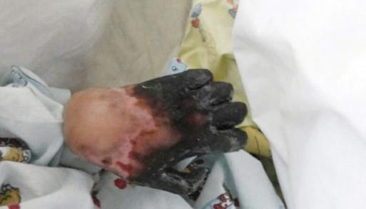 طفلة القطيف