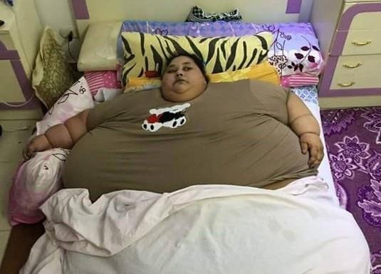 مصرية وزنها نصف طن ولم تخرج من منزلها منذ ربع قرن