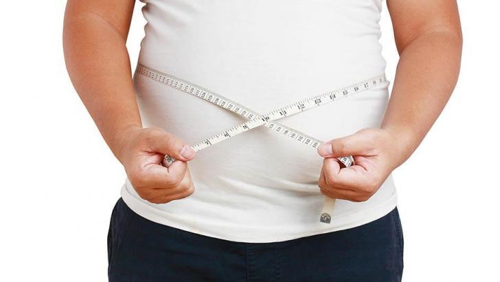 السمنة السمنة