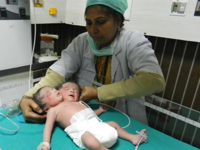 طفله براسين