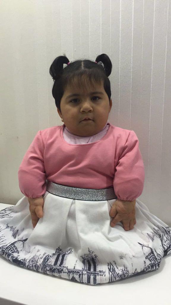 وُلدت دون قدمين وبأطراف مشوّهة.. الطفلة 