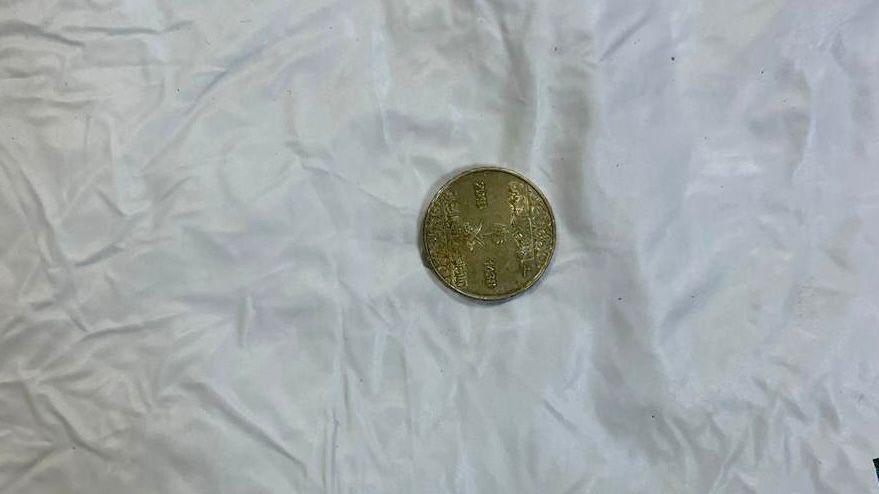 الجوف: إنقاذ طفلة عقب انسداد مجرى الهواء بقطعة معدنية