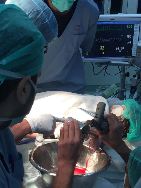 مدني جدة يحرر يد طفل من فرامة لحم داخل غرفة العمليات