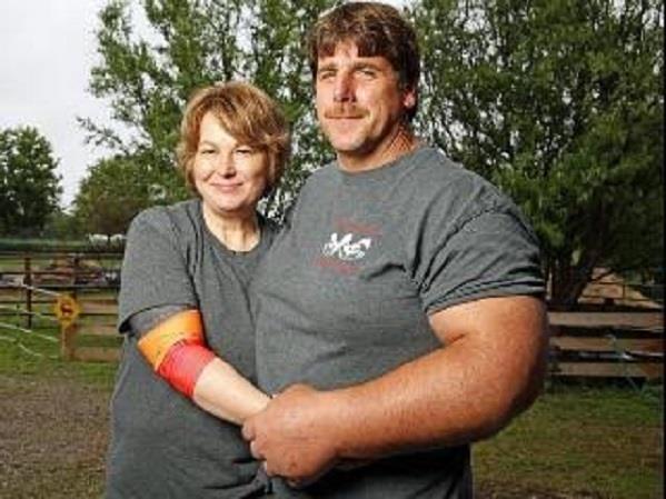 أمريكي يمتلك يدًا ضخمة تشبه يد شخصية باباي الكرتونية- صور