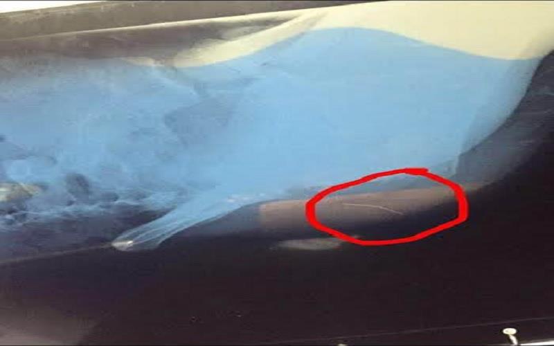 جازان: ممرضة تكسر 