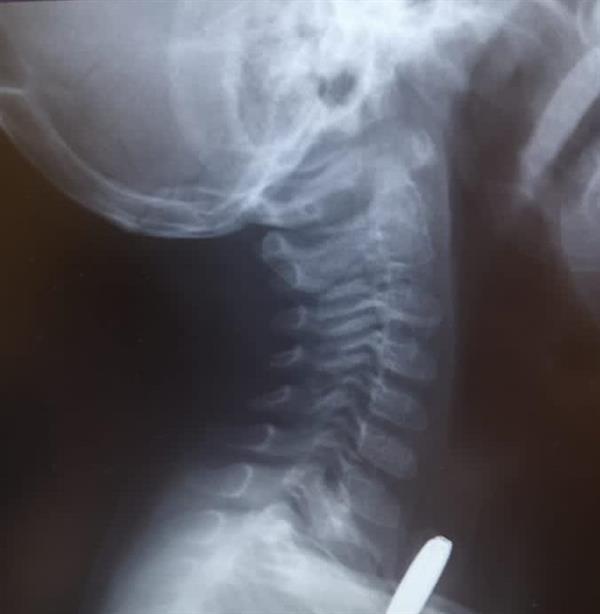 مستشفى بيشة