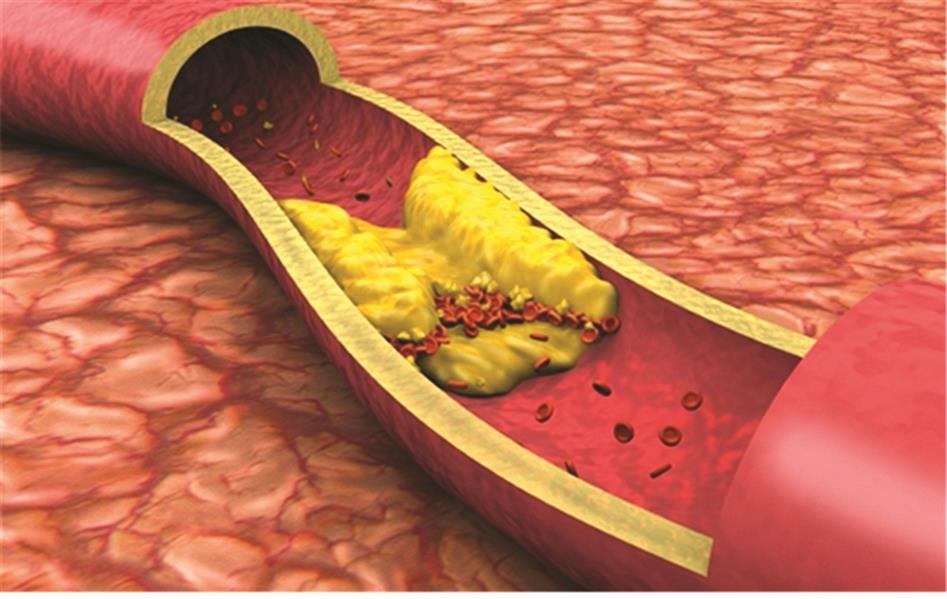 خاليان من الكولسترول