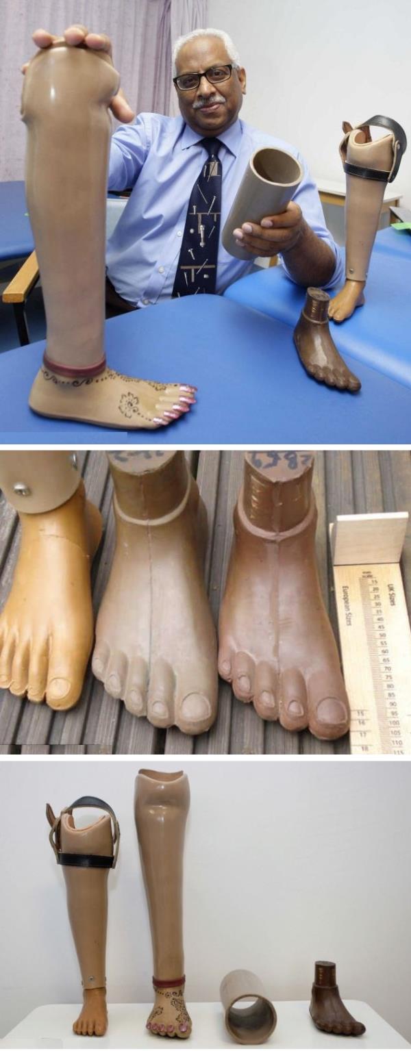  طبيب بريطاني يبتكر أقداماً صناعية