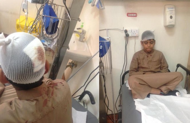 إصابة مصلين إثر سقوط قطع من «الرخام» لأحد أعمدة المساجد في عفيف - صور إصابة مصلين إثر سقوط قطع من «الرخام» لأحد أعمدة المساجد في عفيف - صور