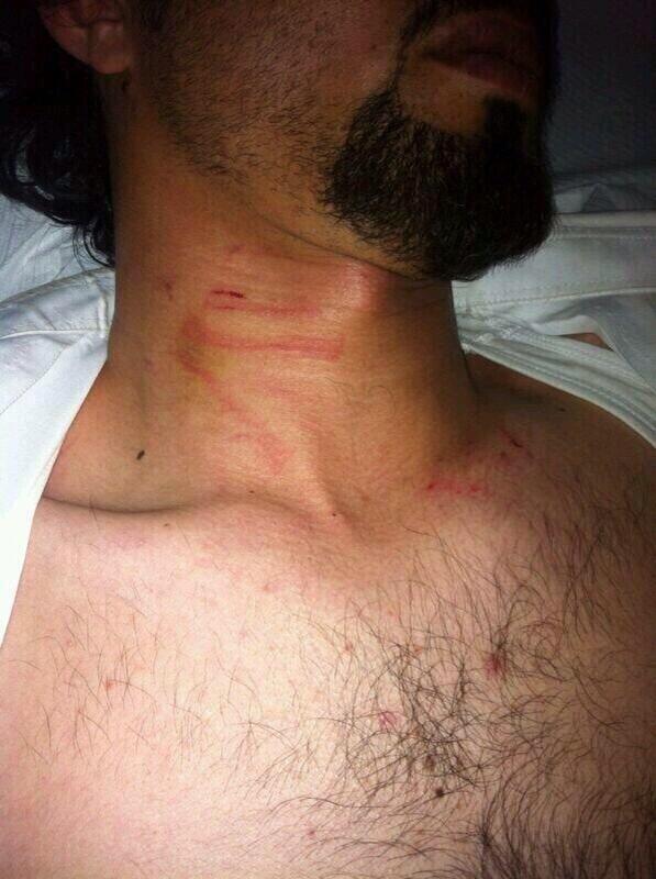 اصابة  بائع العثيم