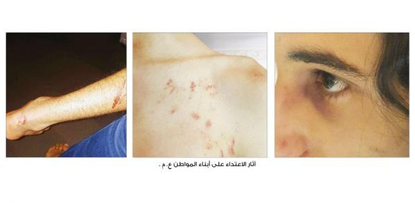 نجل المواطن الذي تعرض للضرب نجل المواطن الذي تعرض للضرب