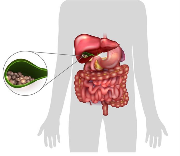 هل التفتيت هو الأفضل؟